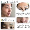 Minako様からムントジリの体験　頬のシミ、おでこの吹きでもの、鼻の毛穴、両目のバランスが整った
